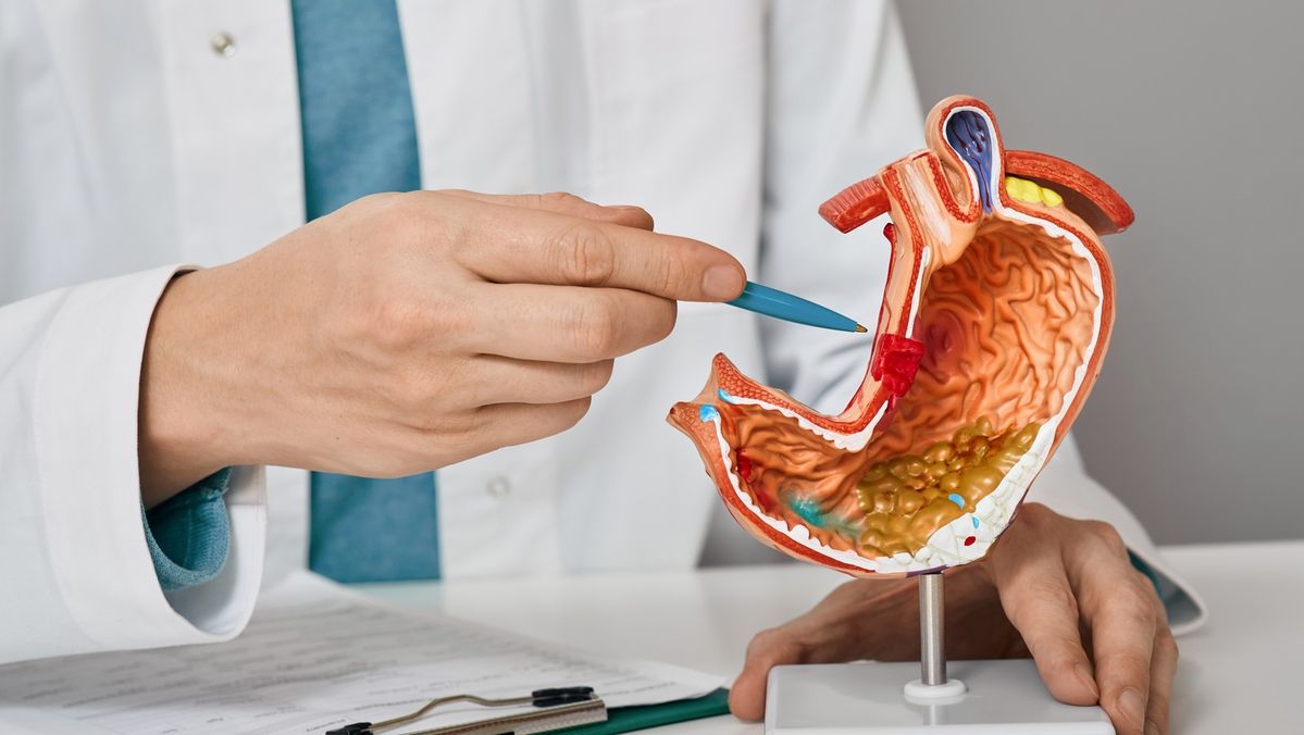Stomach Cancer Surgery